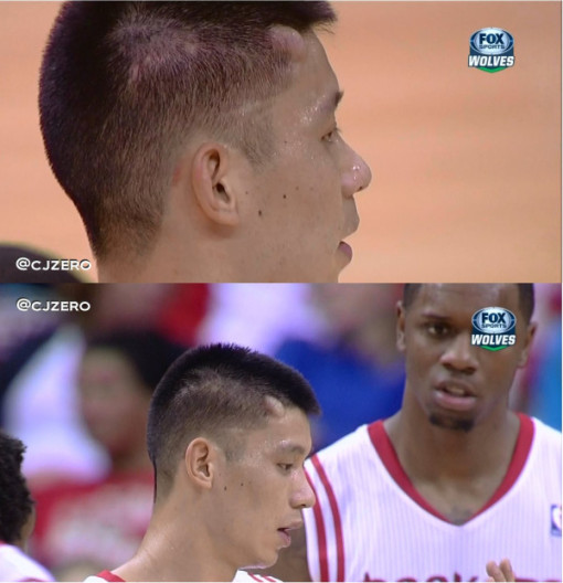 Jeremy Lin elbowed, gets huge bump on head