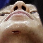 Jeremy Lin chin wound against Washington
